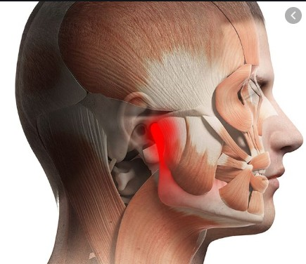 TMJ Surgery 2